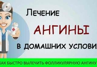 Как лечить фолликулярную ангину